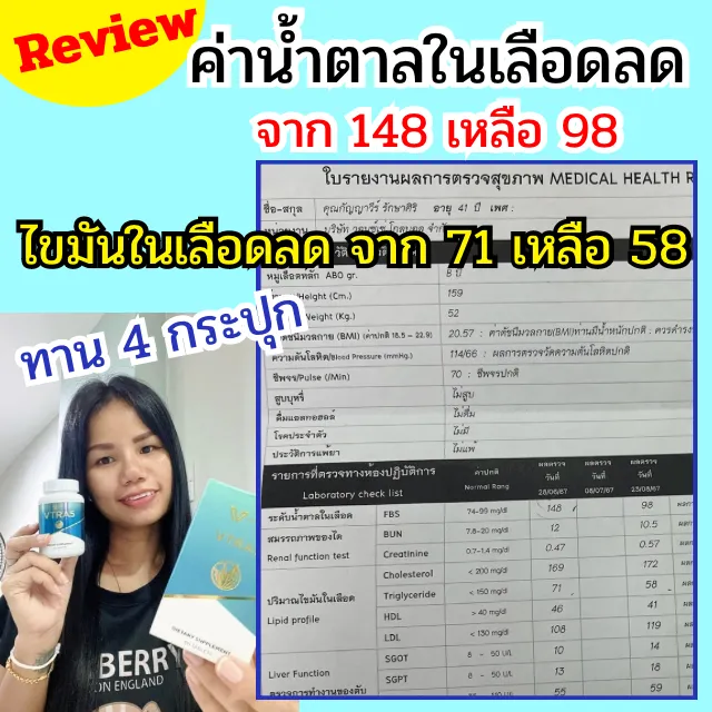 VTRA5 รีวิวนุ้ย